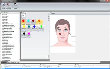 Picasso EMR Visual Findings