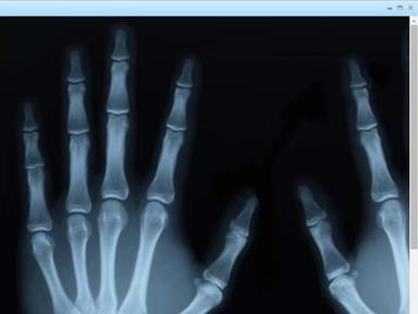 Absolute EMR X-Ray views