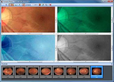 Acuitas activEHR Photo comparison