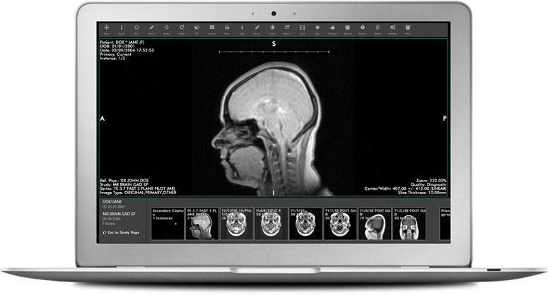 Ambra Health Viewer