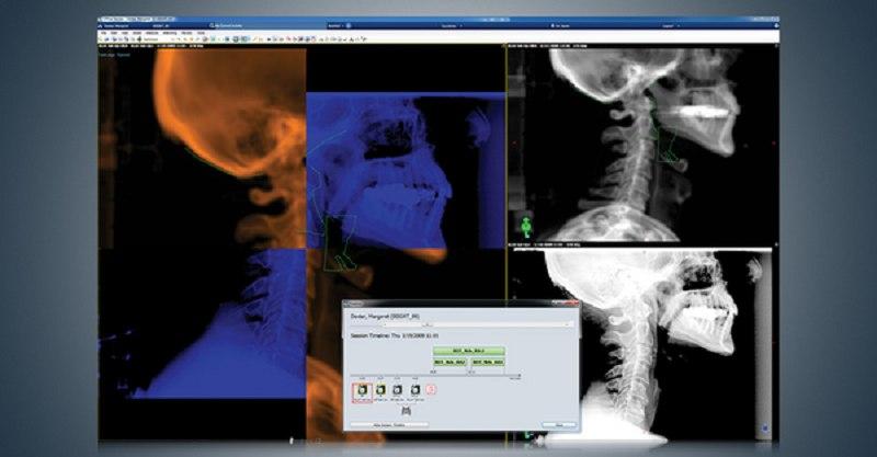 Aria Oncology EHR Offline review