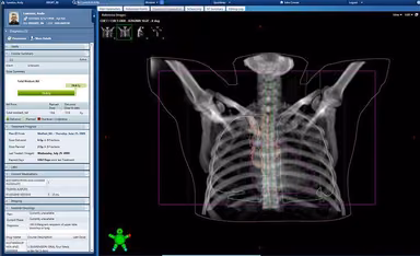 Aria Oncology EHR Imaging
