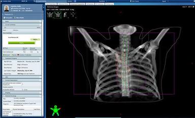 Aria Oncology EHR Imaging
