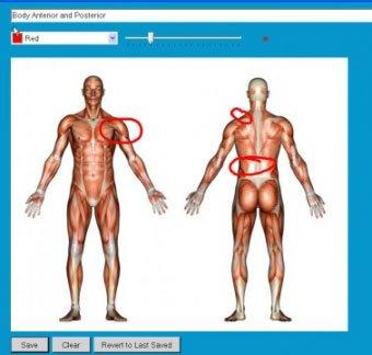 Chiro QuickCharts EHR Inking graphics