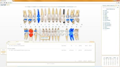Curve Dental EHR Charts
