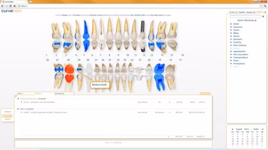 Curve Dental EHR Charts