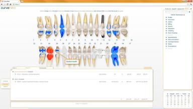 Curve Dental EHR Charts