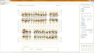 Curve Dental EHR Custom charts