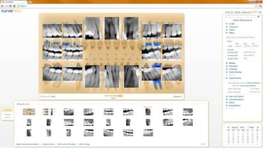 Curve Dental EHR Images