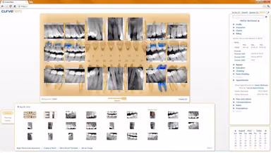 Curve Dental EHR Images