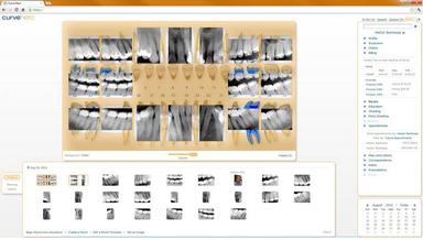 Curve Dental EHR Images