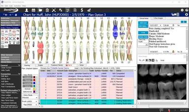 DentiMax Charts