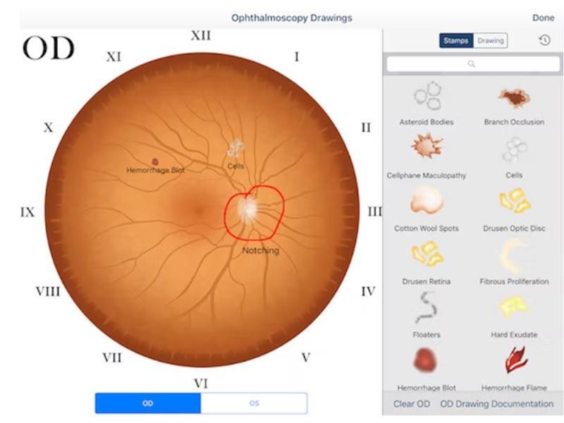 EyePegasus Ophthalmoscopy Drawings