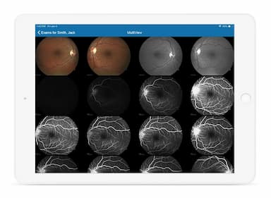 Eyefinity EHR Image management