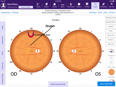 EMA® Telehealth-Enabled EHR Ophthalmology