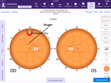 ModMed EMR Ophthalmology