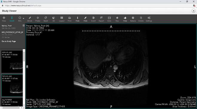Nexus DICOM imaging screen