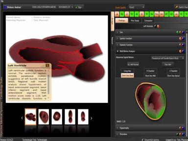 OMS EHR Echocardiogram