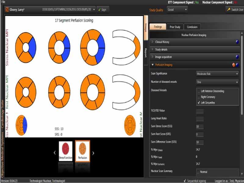OMS EHR Nuclear perfusion-reporting