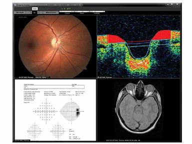 EyeMD EMR Software Images