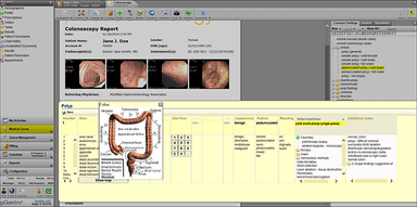 gGastro Procedure note - ERW with anatomy map