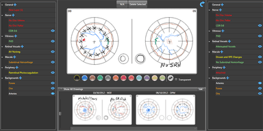 IntelleChart EHR Drawings