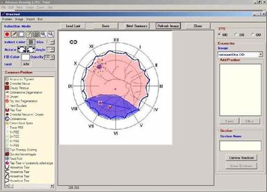 Medflow Ophthalmology EMR  Drawing tools