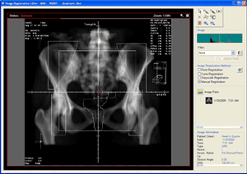 MOSAIQ EMR Image management