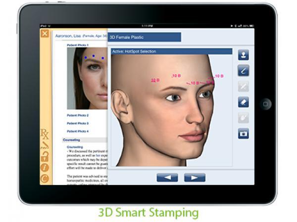 Nextech EMR - 3D Smart Stamping