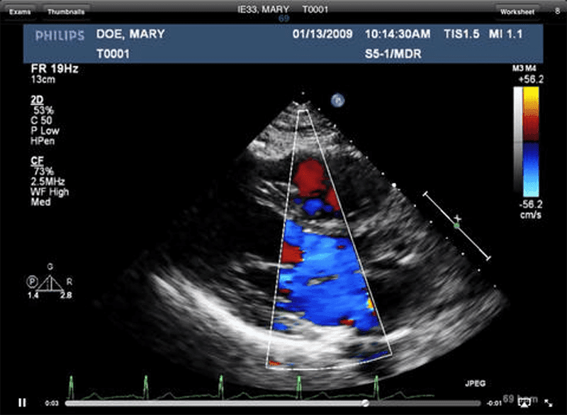 UltraLinQ EMR Software