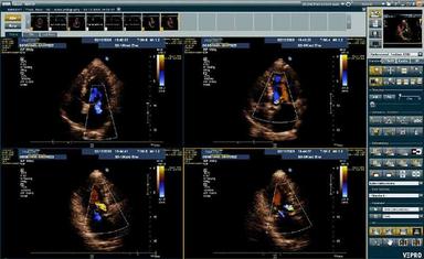VEPRO Ultrasound