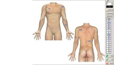 Encite-3