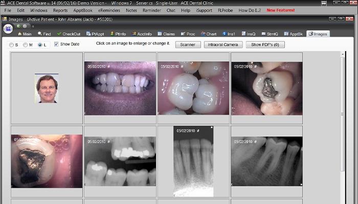 ACE Dental Easily Stored Images