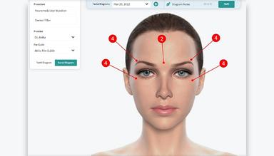 Akitu One Facial Charting can be used for Botox and Dermal Filler Charting