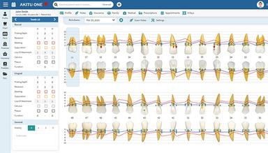 Akitu One Modern Perio Charting with clinical accurate and visually satisfying graphics