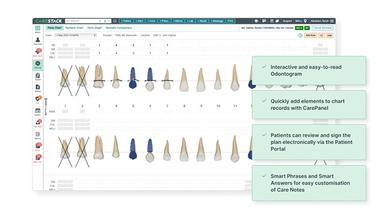 CareStack With online dental charting
