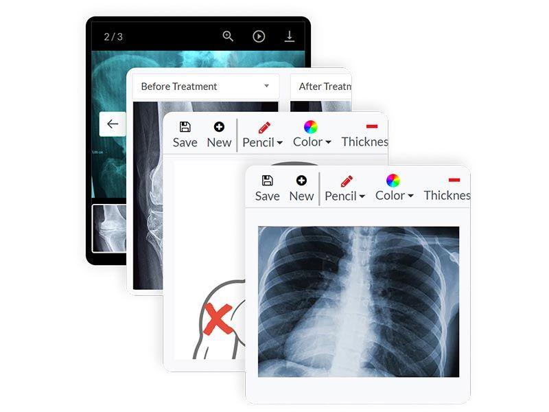 Clinicea Imaging lets you annotate, take pictures, and more, on the cloud