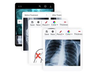 Clinicea Imaging lets you annotate, take pictures, and more, on the cloud