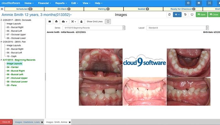 Cloud 9 Ortho Pediatric View
