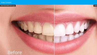 Dentiflow Image Store and Compaore