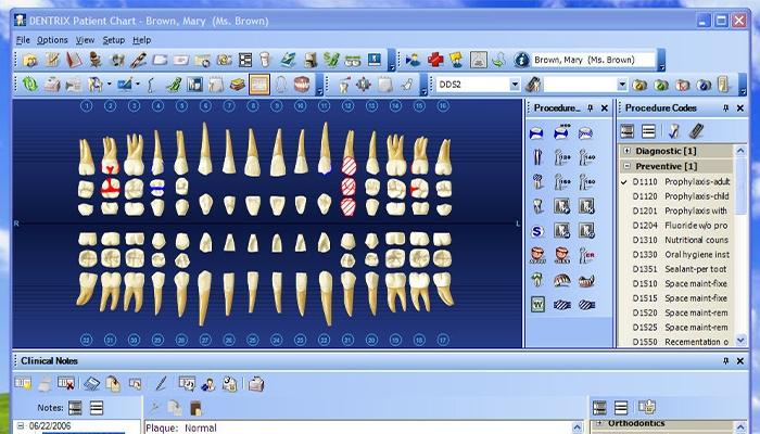 Dentrix 1