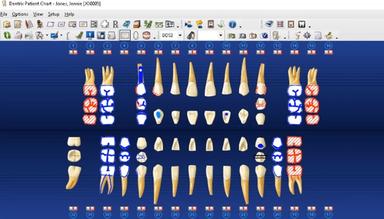 Dentrix 2