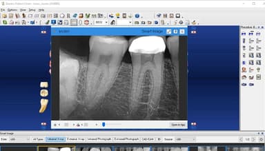 Dentrix 3