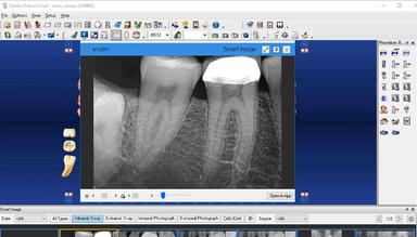 Dentrix 3