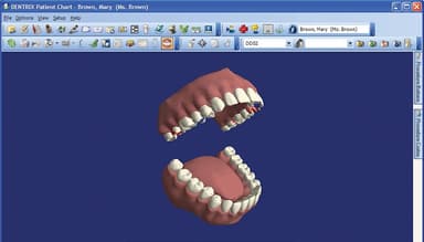 Dentrix 4