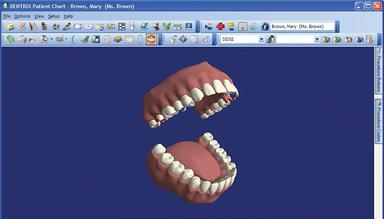 Dentrix 4