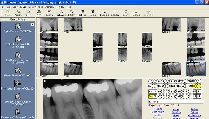 Eaglesoft Imaging