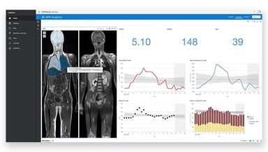 Oracle Analytics Cloud MRI Analytics