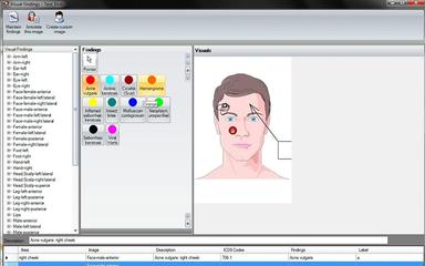 Picasso EMR Visual Findings