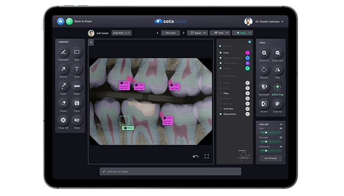 Sota Cloud Intelligent Imaging with A.I Capabilities